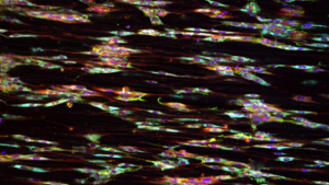 Brightly coloured squiggles on a black background to represent ligament tissue