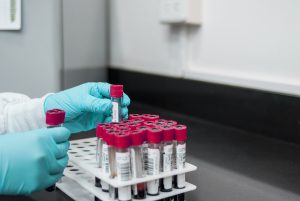 Blood tubes being placed in a rack by a person only shown by gloved hands